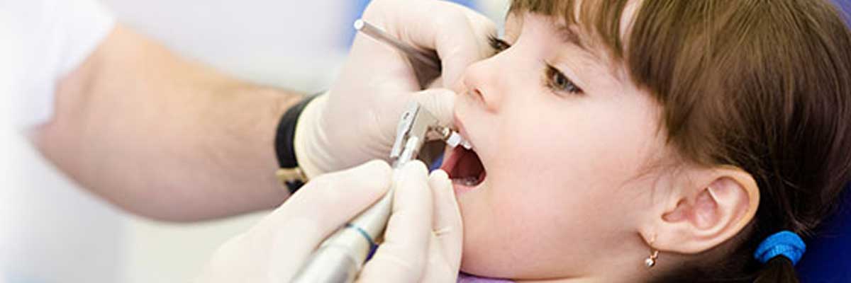 Parker Dental Procedures