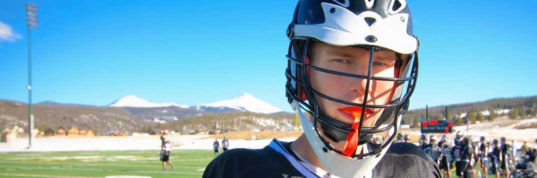 Parker Mouth Guards
