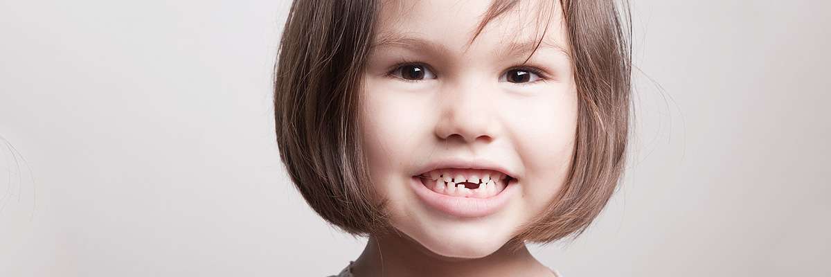 Parker Pediatric Dentist